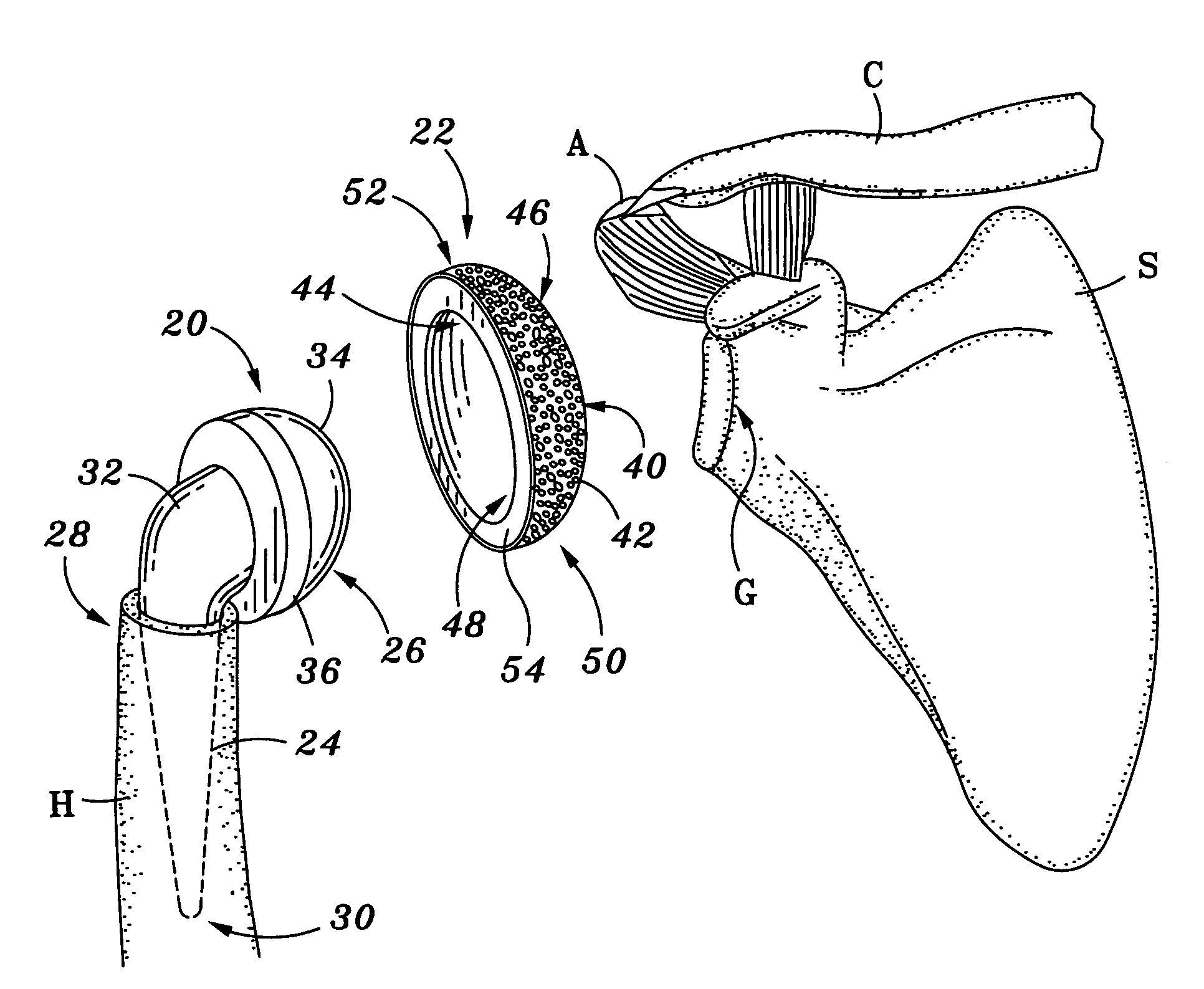 Method and apparatus for shoulder arthroplasty