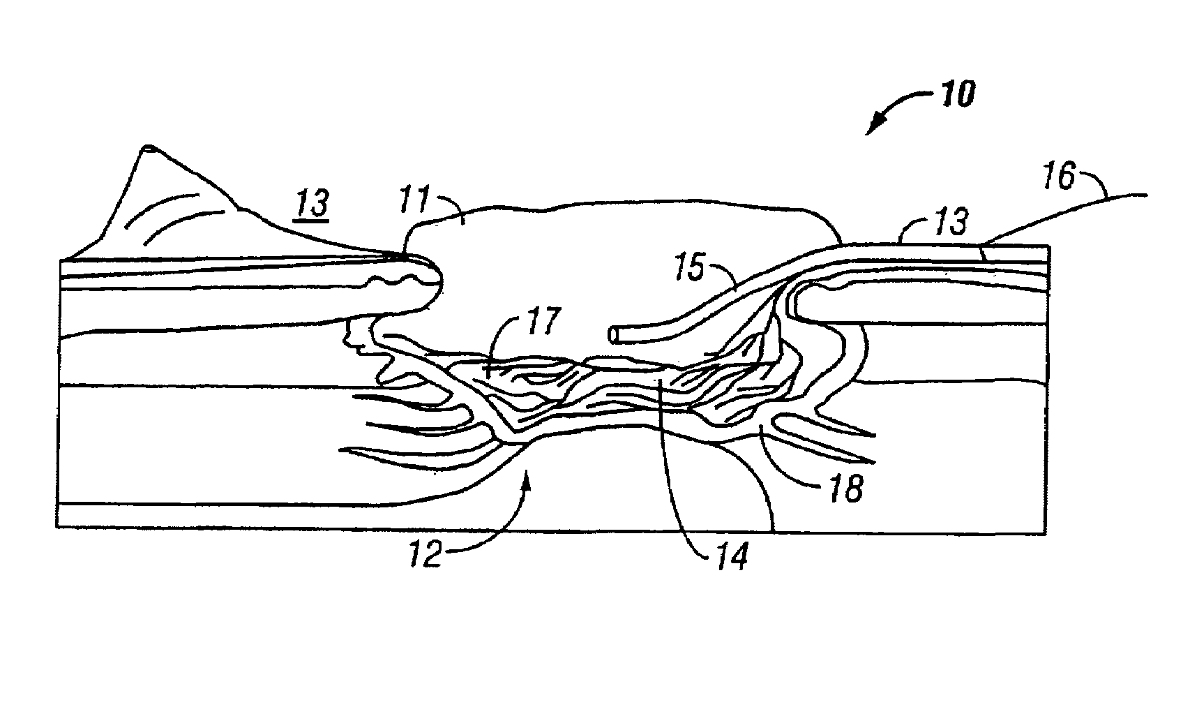 Vacuum assisted closure pad with adaptation for phototherapy