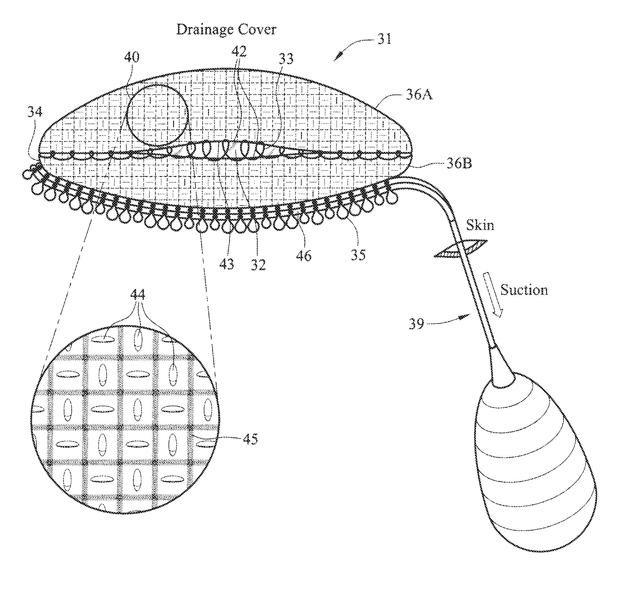 IMPLANTABLE MICRO-TEXTURED SCAR INDUCING ePTFE STRUCTURES