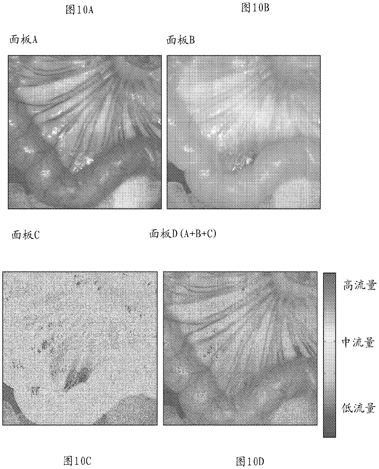 Multi-spectral laser imaging (MSLI) methods and systems for blood flow and perfusion imaging and quantification