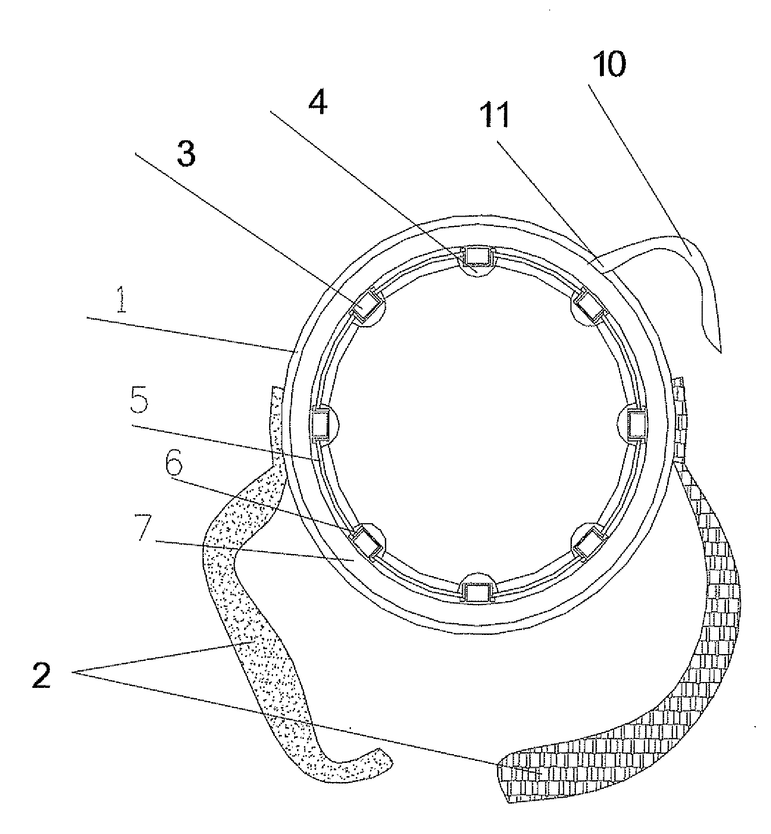 Ultrasonic Therapeutic Device Capable of Multipoint Transmitting