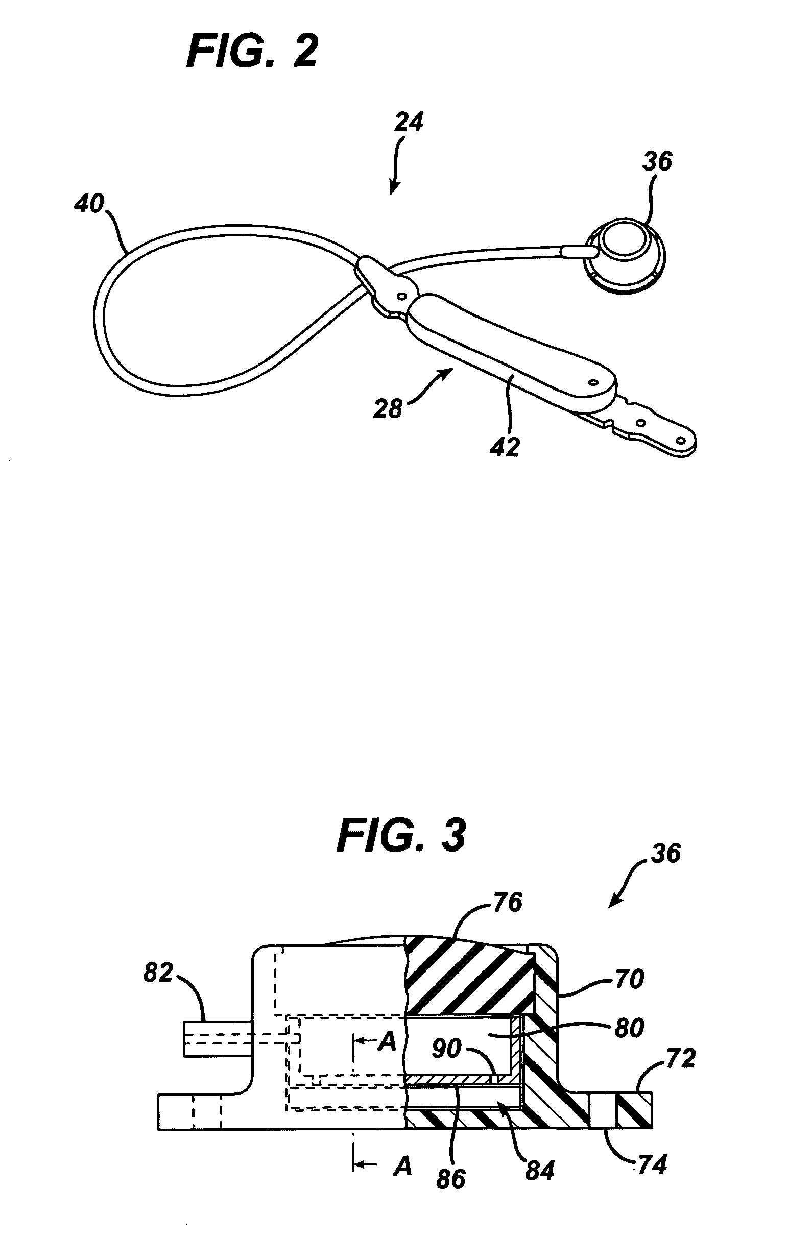 Data Analysis for an Implantable Restriction Device and a Data Logger