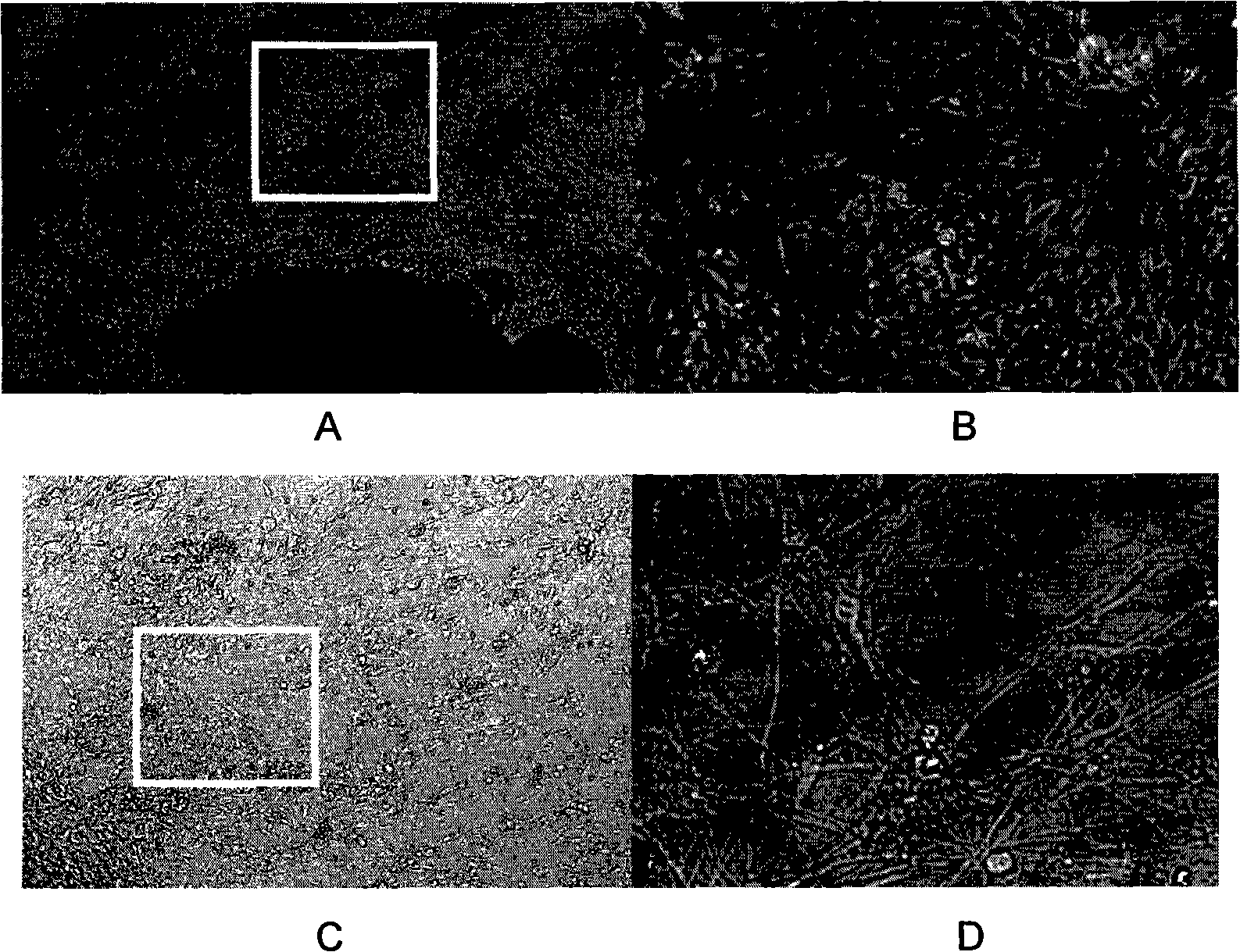 Use of neurocyte differentiated from stem cell induced by isobavachin