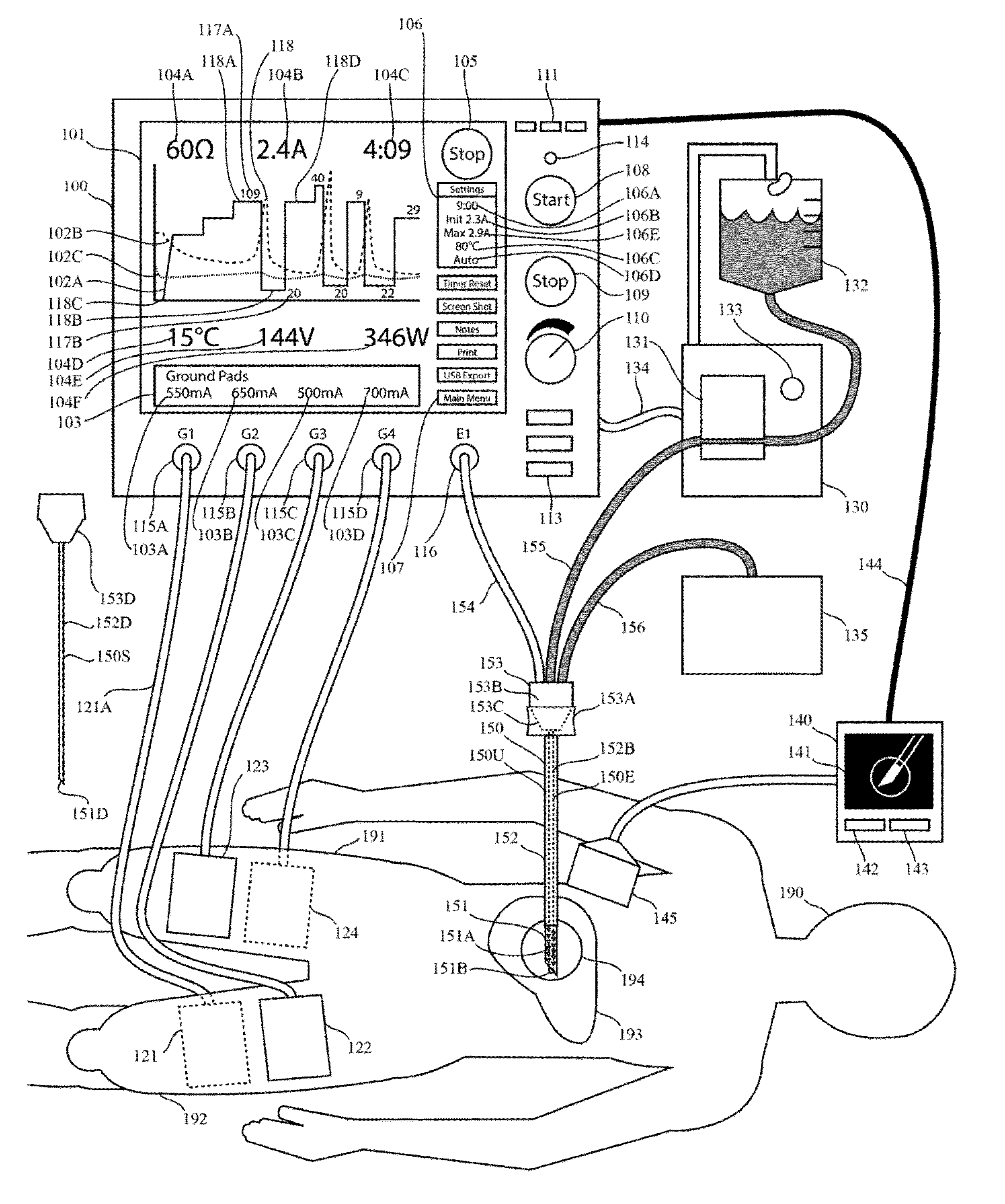 Electrosurgical generator