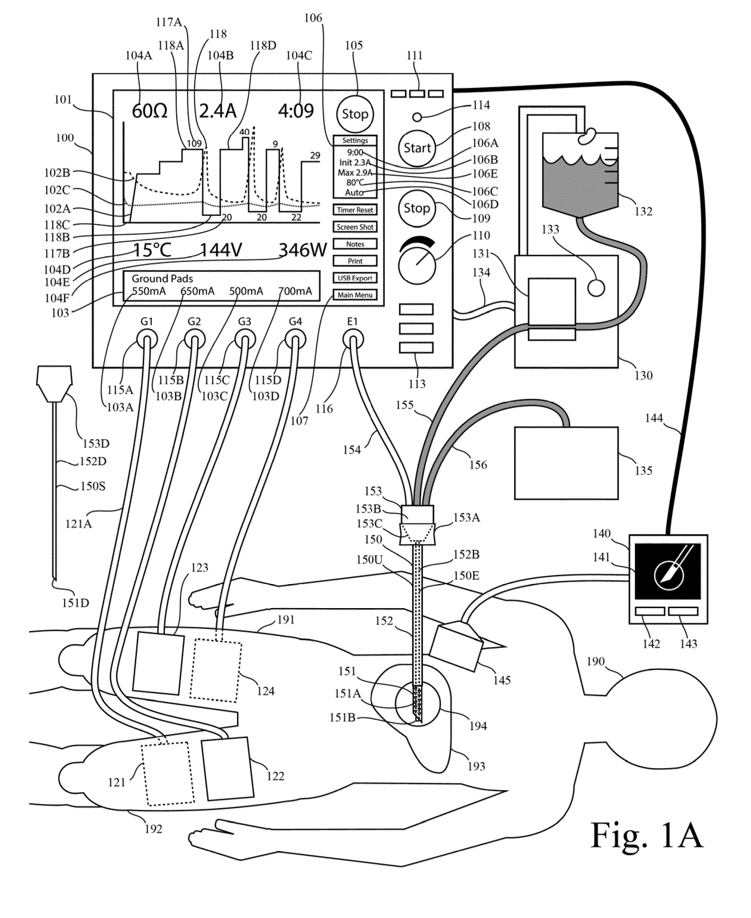 Electrosurgical generator