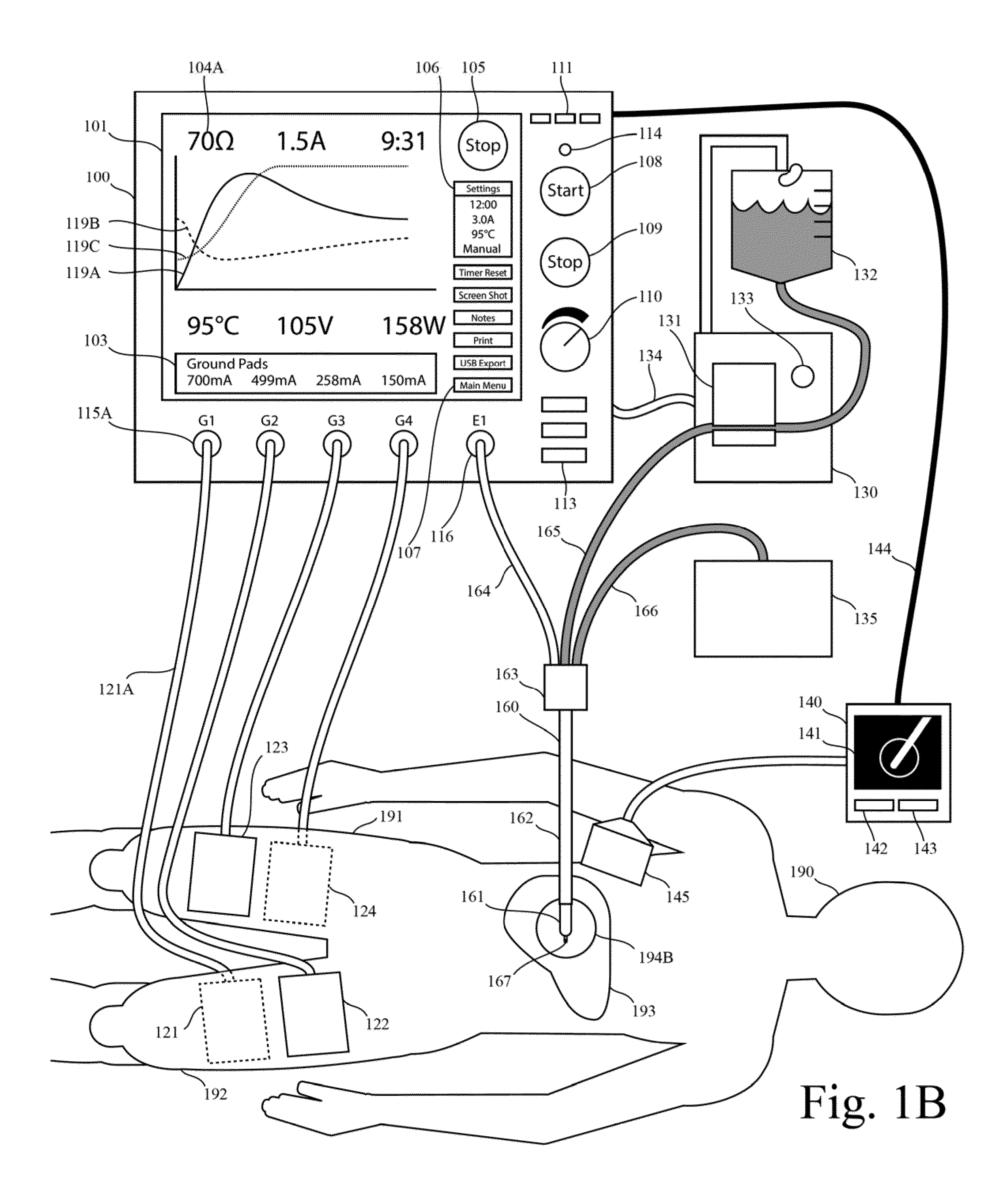 Electrosurgical generator