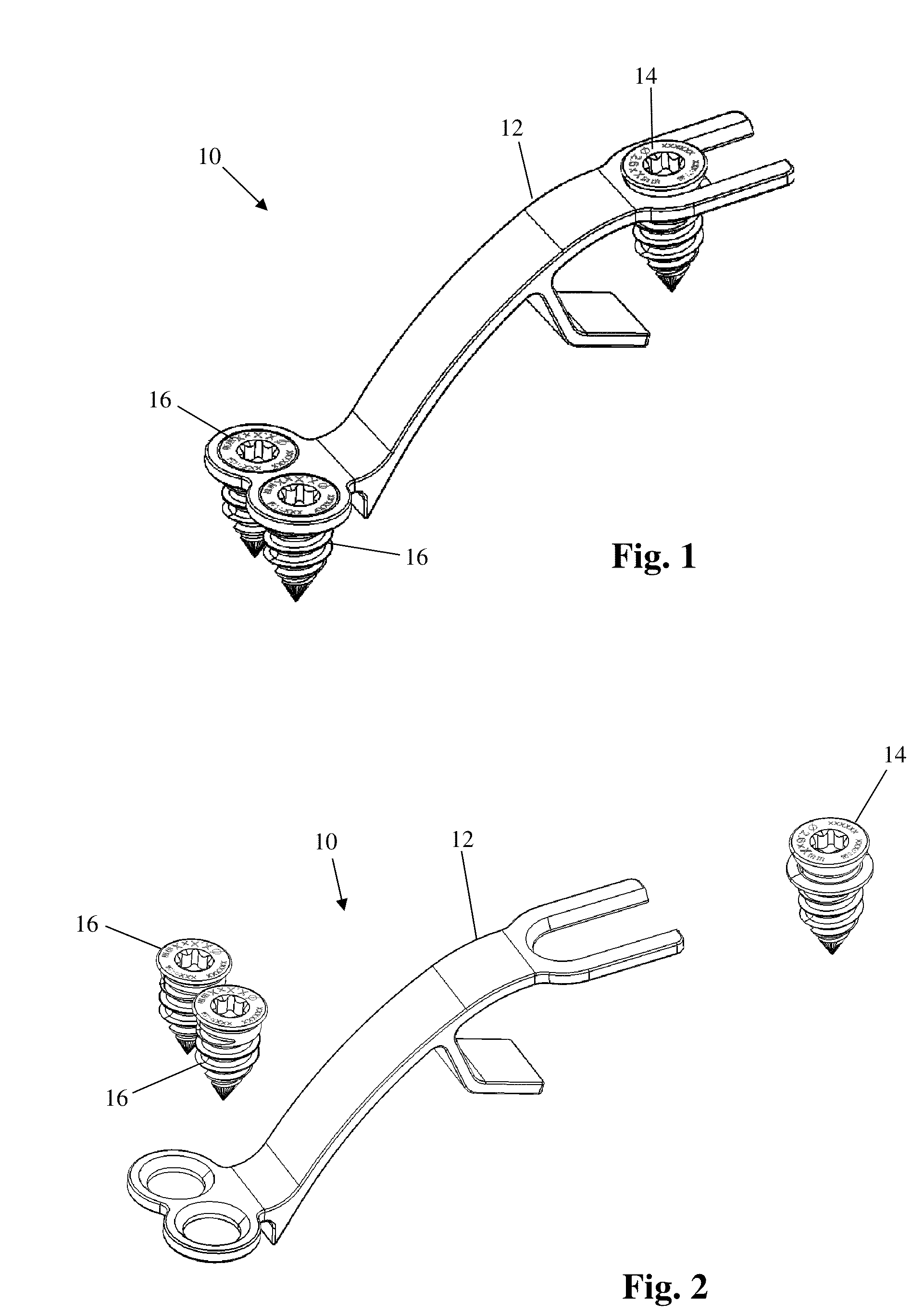 Bone Plate System and Related Methods