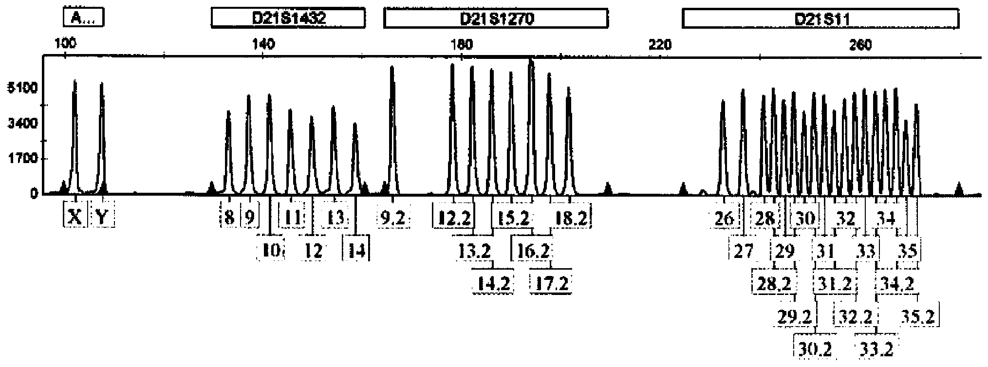 Kit for detecting aneuploidy of five human chromosomes through monotube multiple amplification