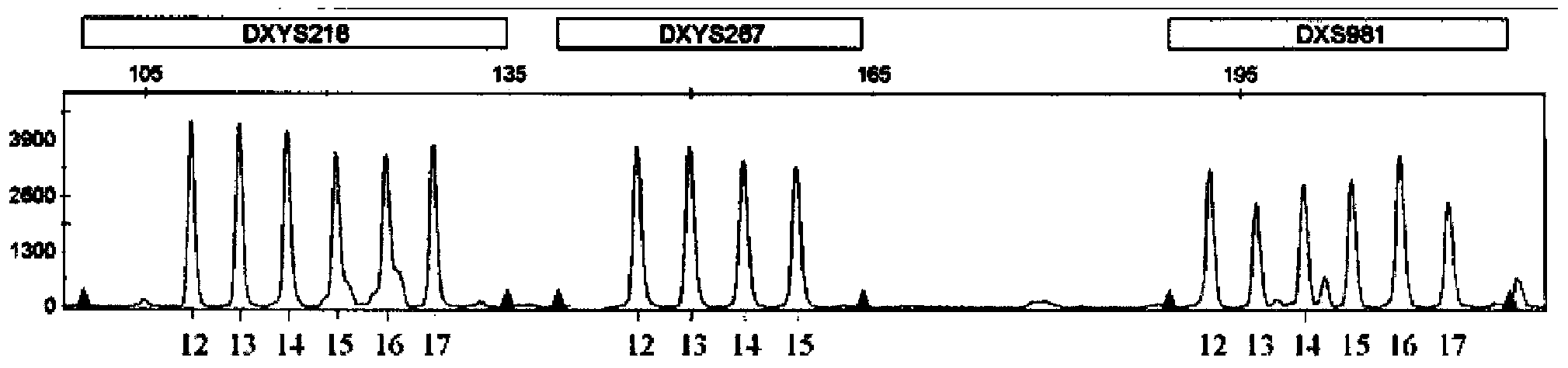 Kit for detecting aneuploidy of five human chromosomes through monotube multiple amplification