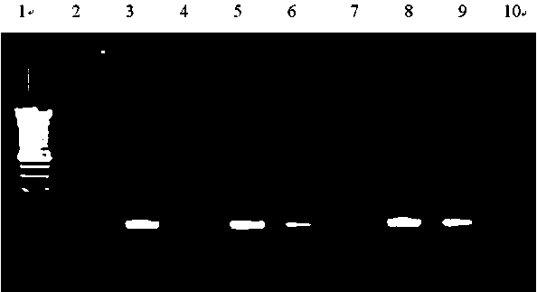 Method, primer, probe, and fluorescence PCR (polymerase chain reaction) kit for detecting gender of fetus in vitro