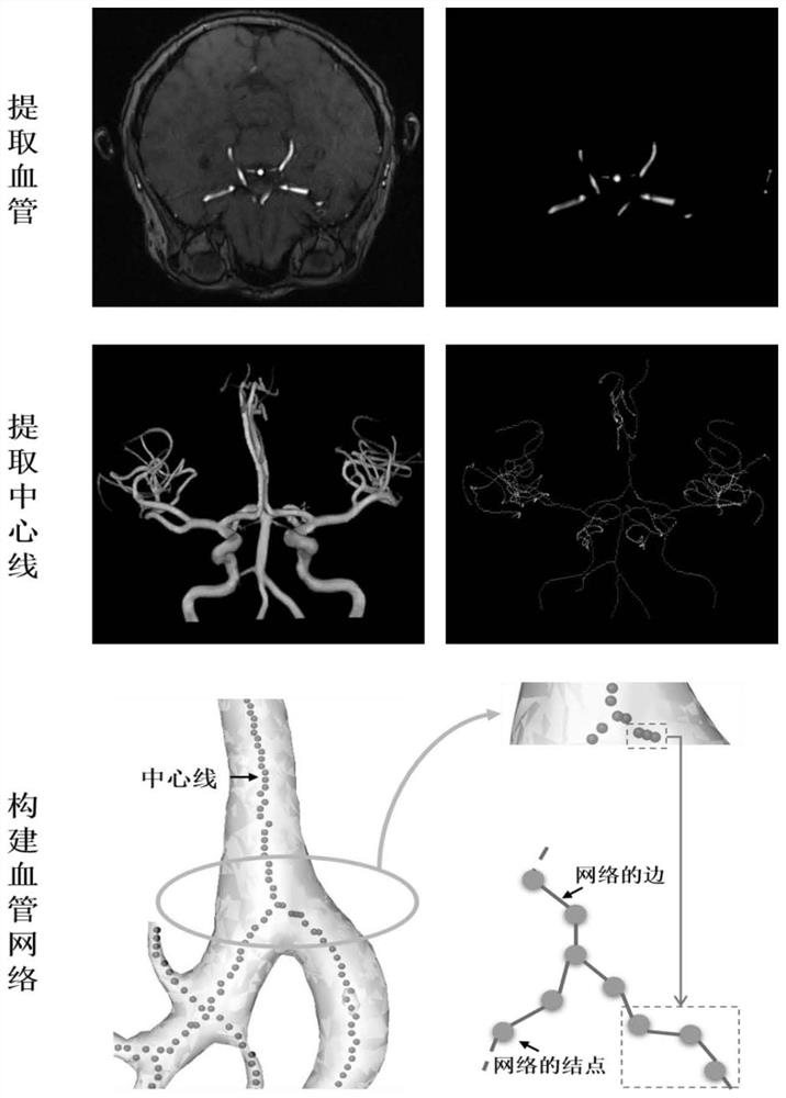 Quantitative Analysis Method of Cerebral Vascular Morphological Characteristics