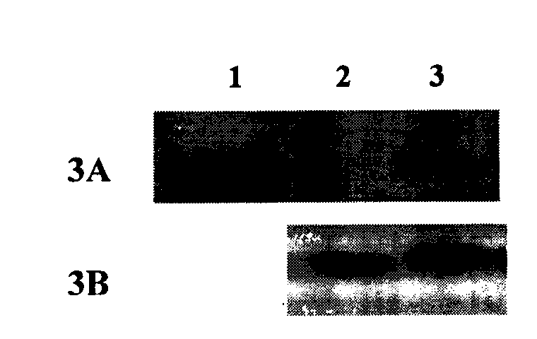 Preparation method of recombinant Fas-associated death domain protein and application thereof