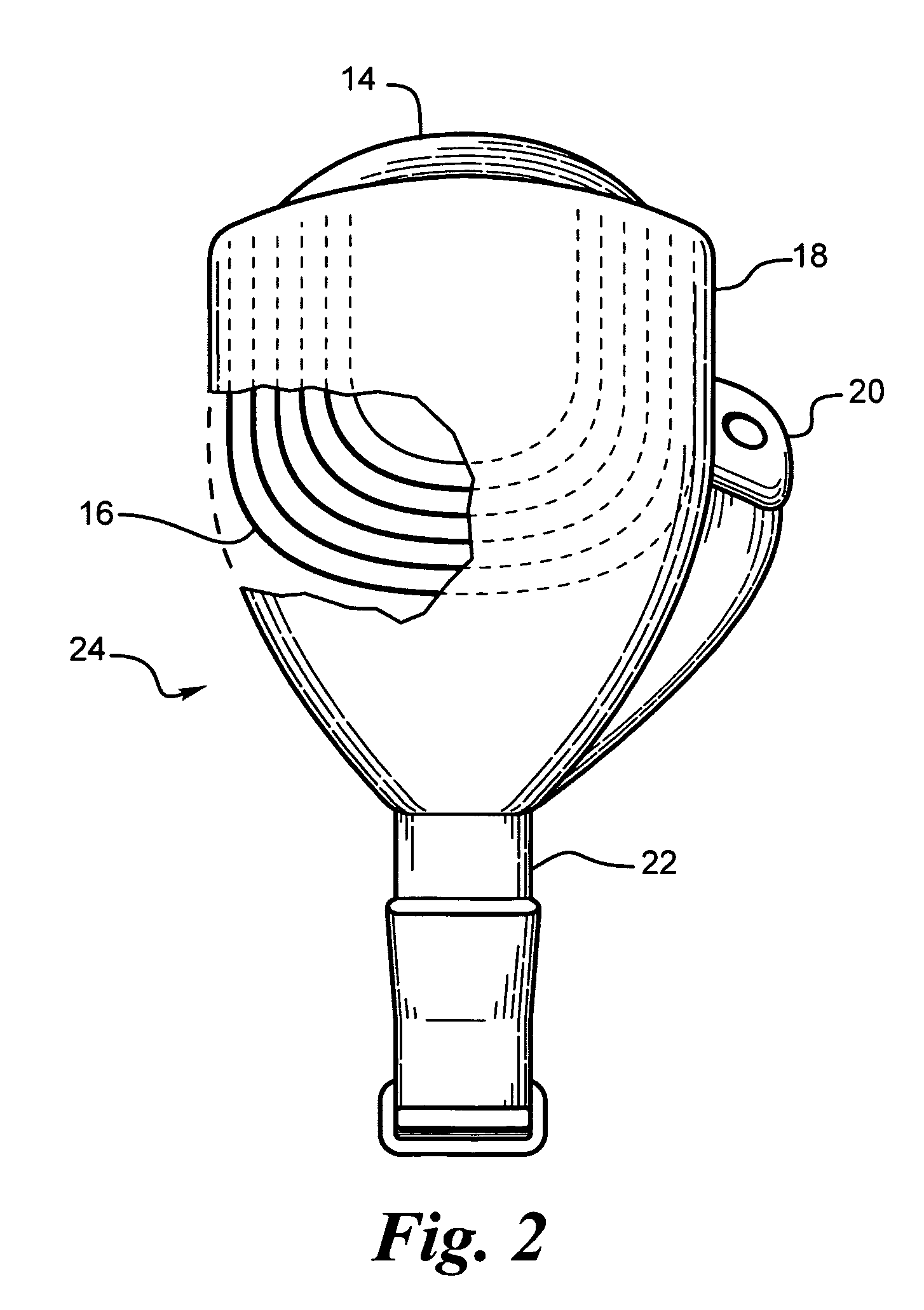 Retinal prosthesis and method of manufacturing a retinal prosthesis