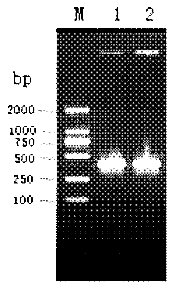 Method for extracting total RNA (Ribonucleic Acid) of grapholita molesta adult antennae