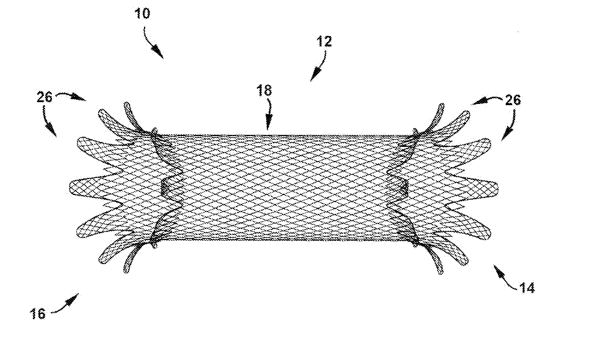 Apparatus and method for treating cardiovascular diseases