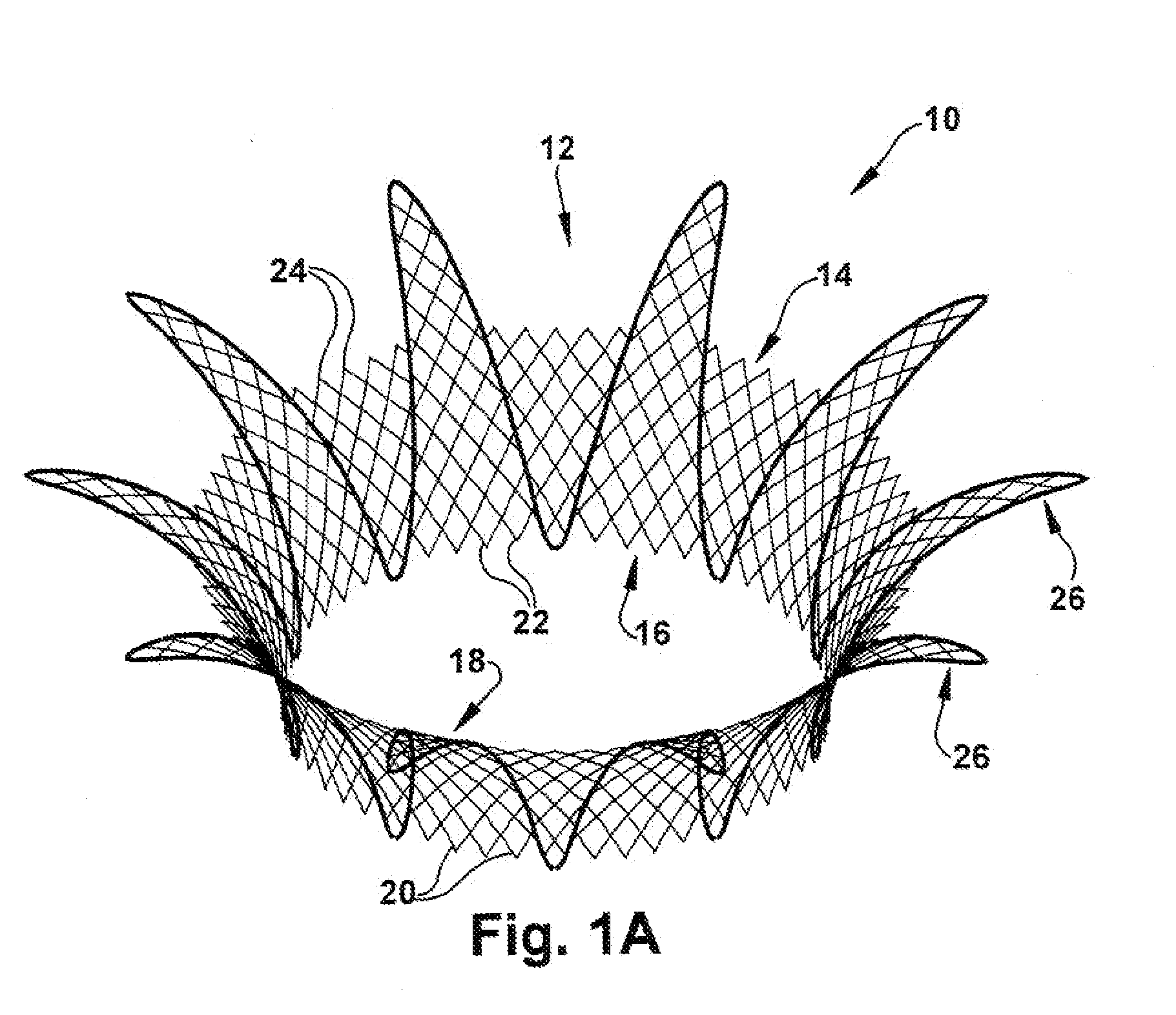 Apparatus and method for treating cardiovascular diseases