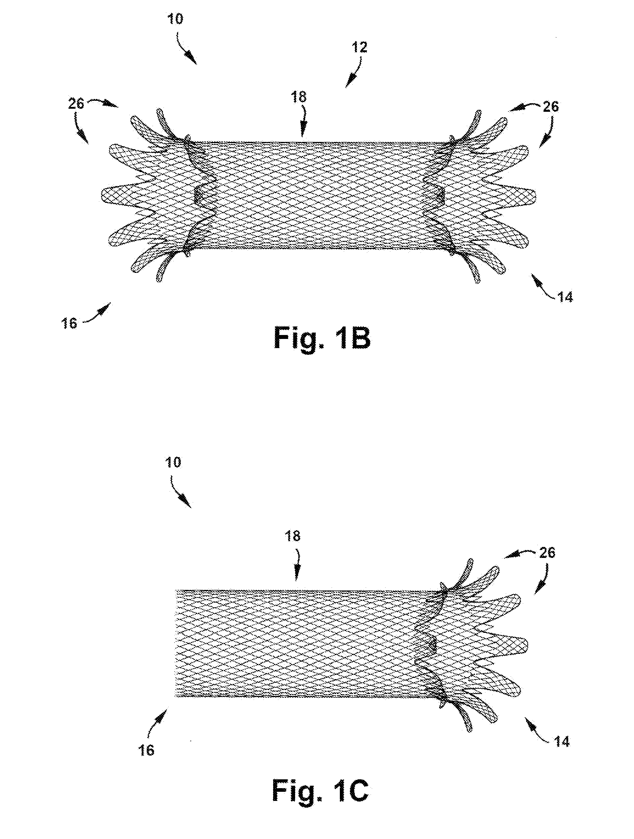 Apparatus and method for treating cardiovascular diseases