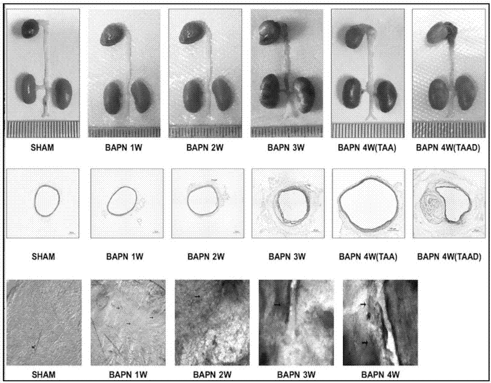 Application of tetratype collagen serving as target spot in early-diagnosis of aortic aneurysm/interlayer