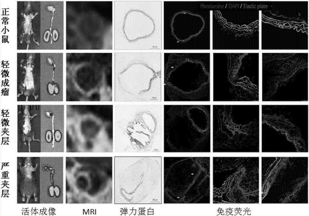 Application of tetratype collagen serving as target spot in early-diagnosis of aortic aneurysm/interlayer