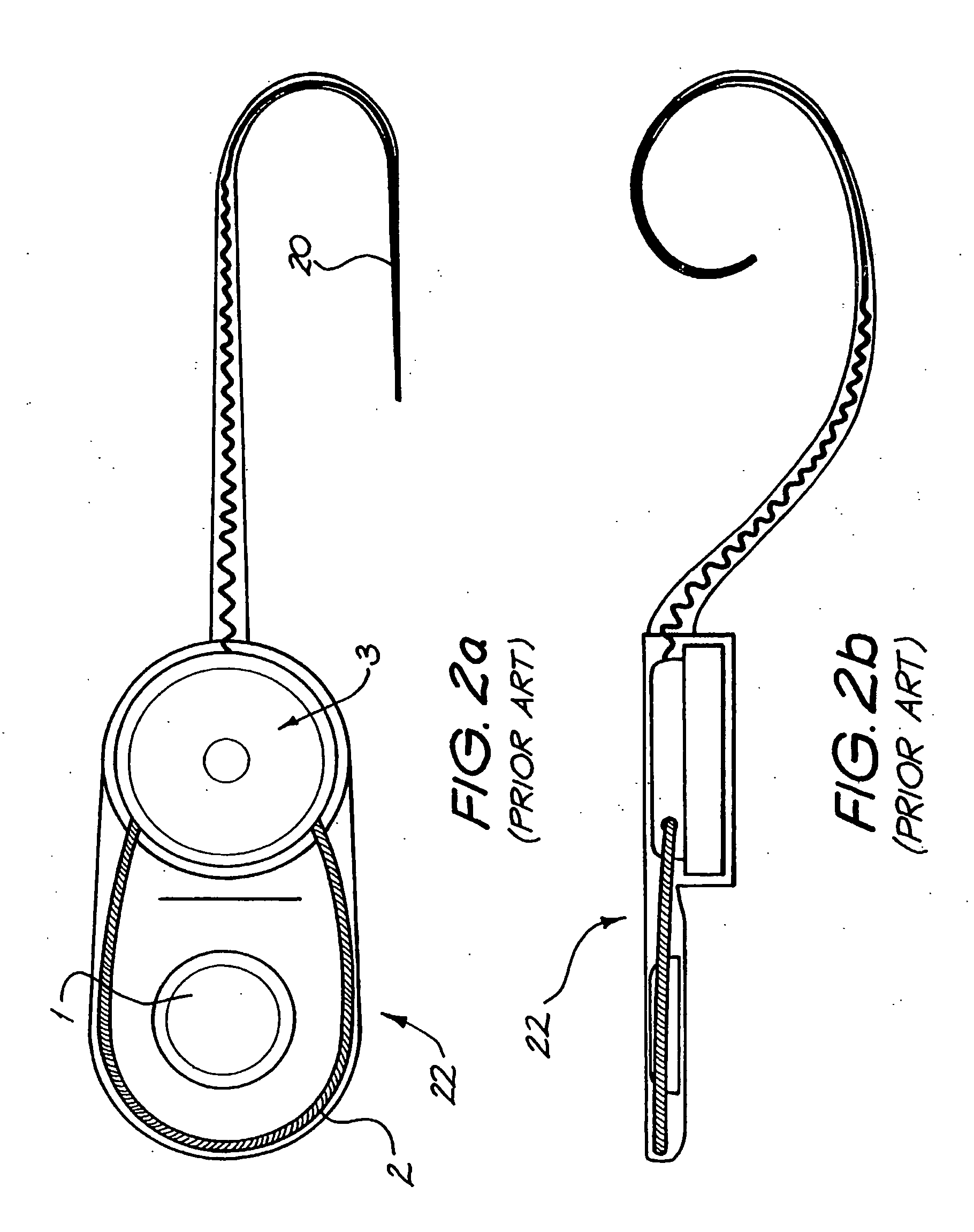 Cochlear implant