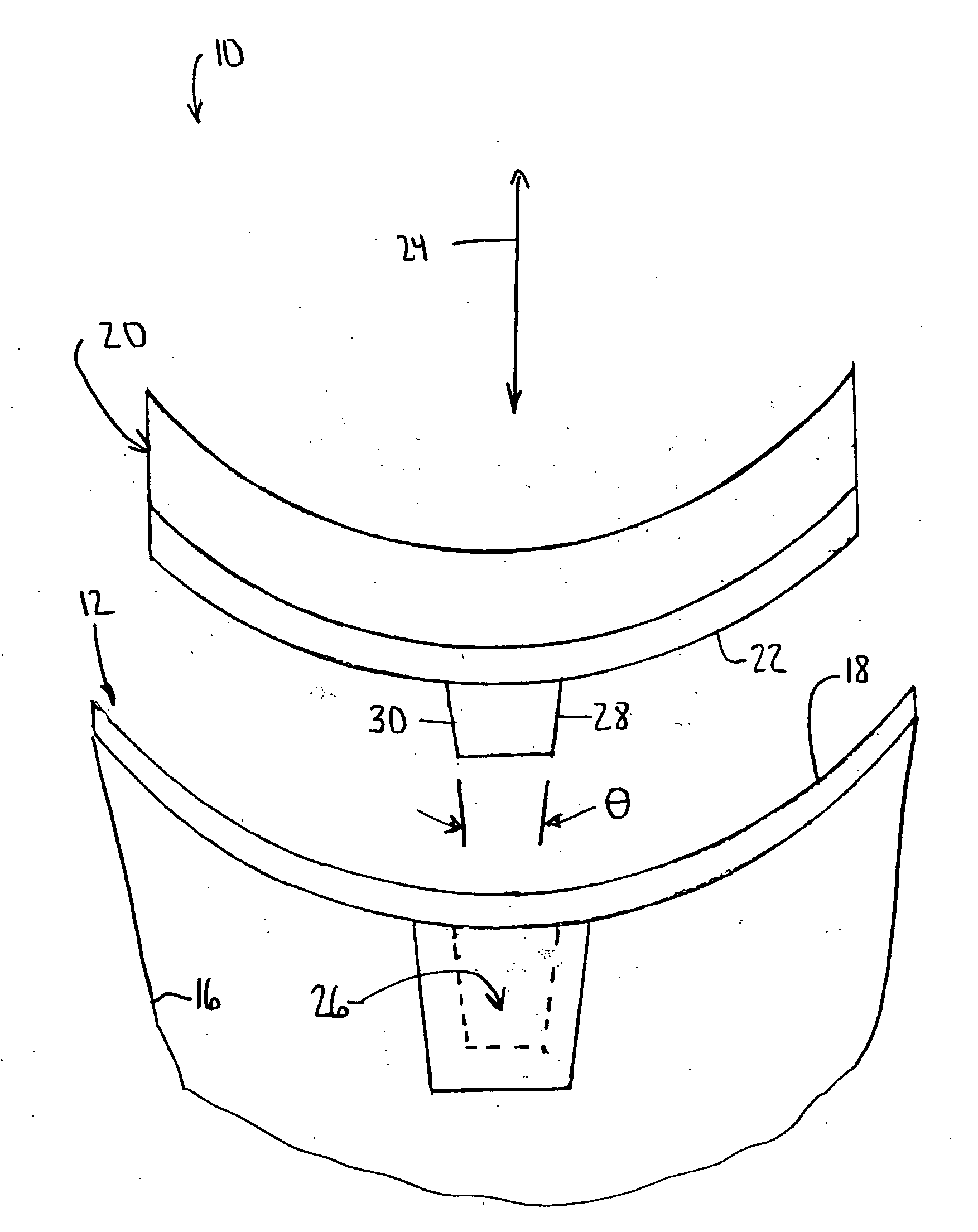 Modular glenoid prosthesis and associated method