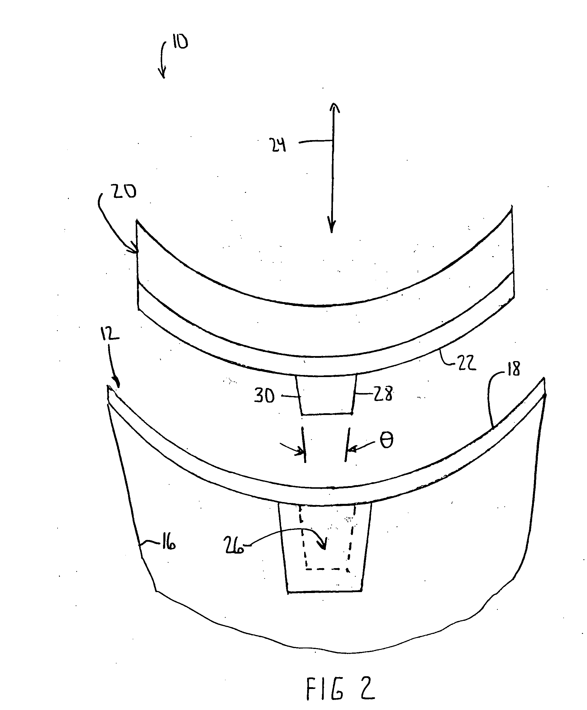 Modular glenoid prosthesis and associated method