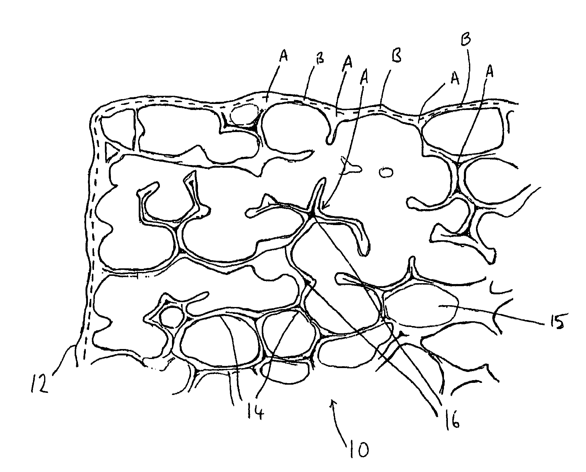 Method for the production of a refractory filter