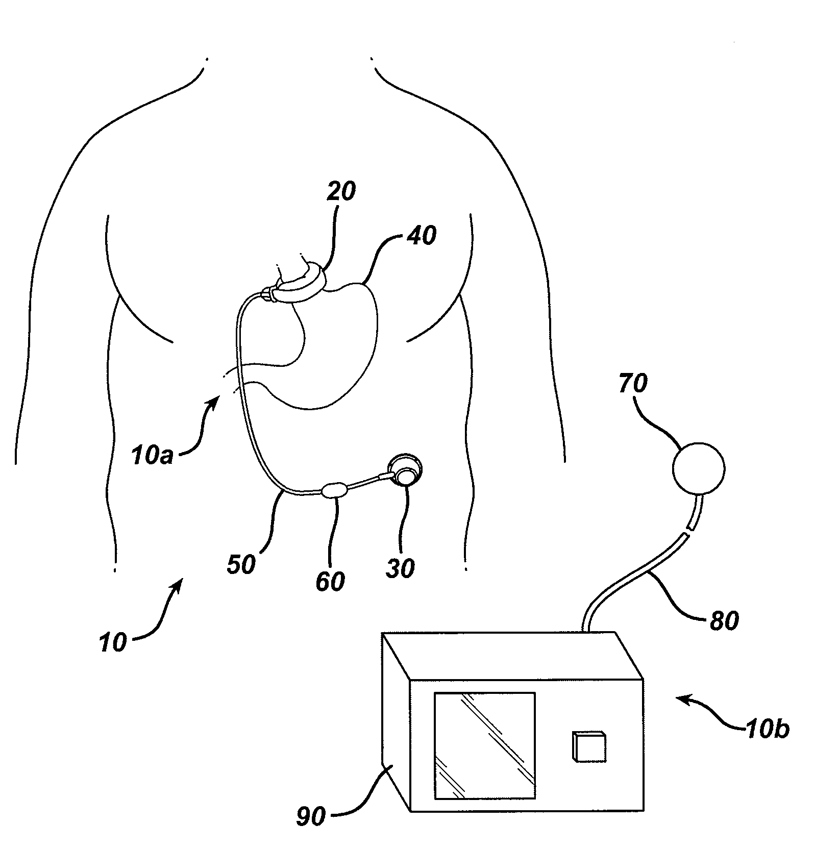 Automatically adjusting band system with MEMS pump