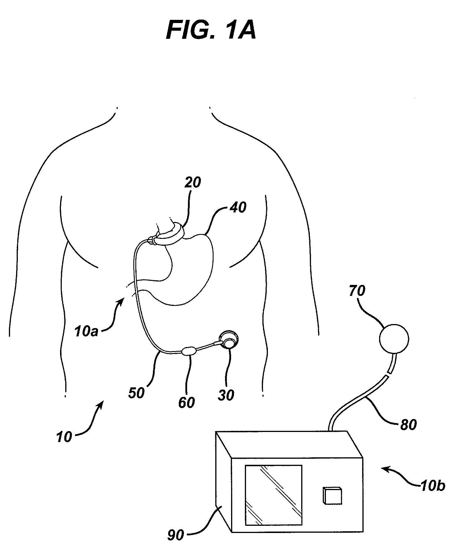 Automatically adjusting band system with MEMS pump