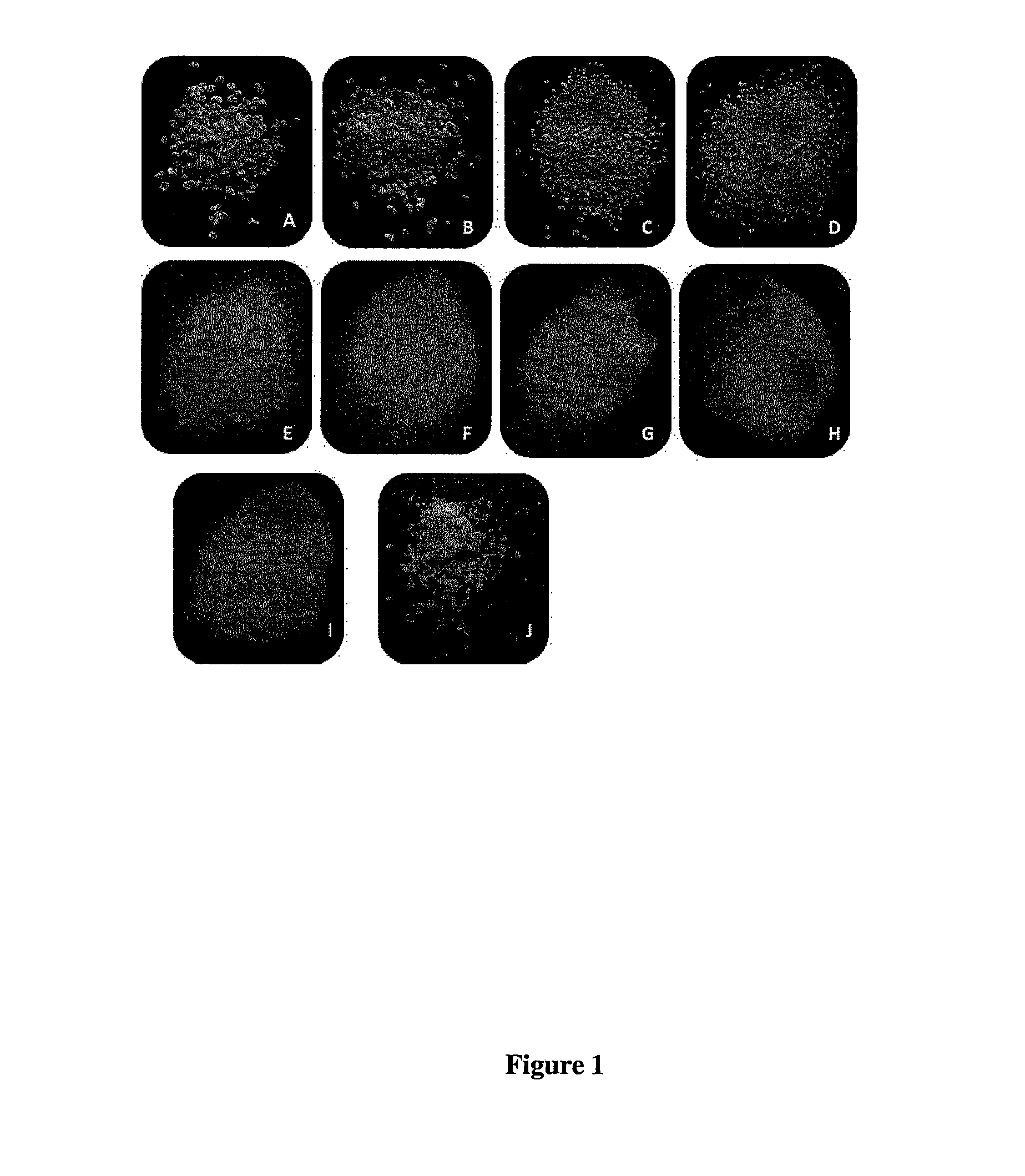 Cryopreservation of cells, tissues and organs