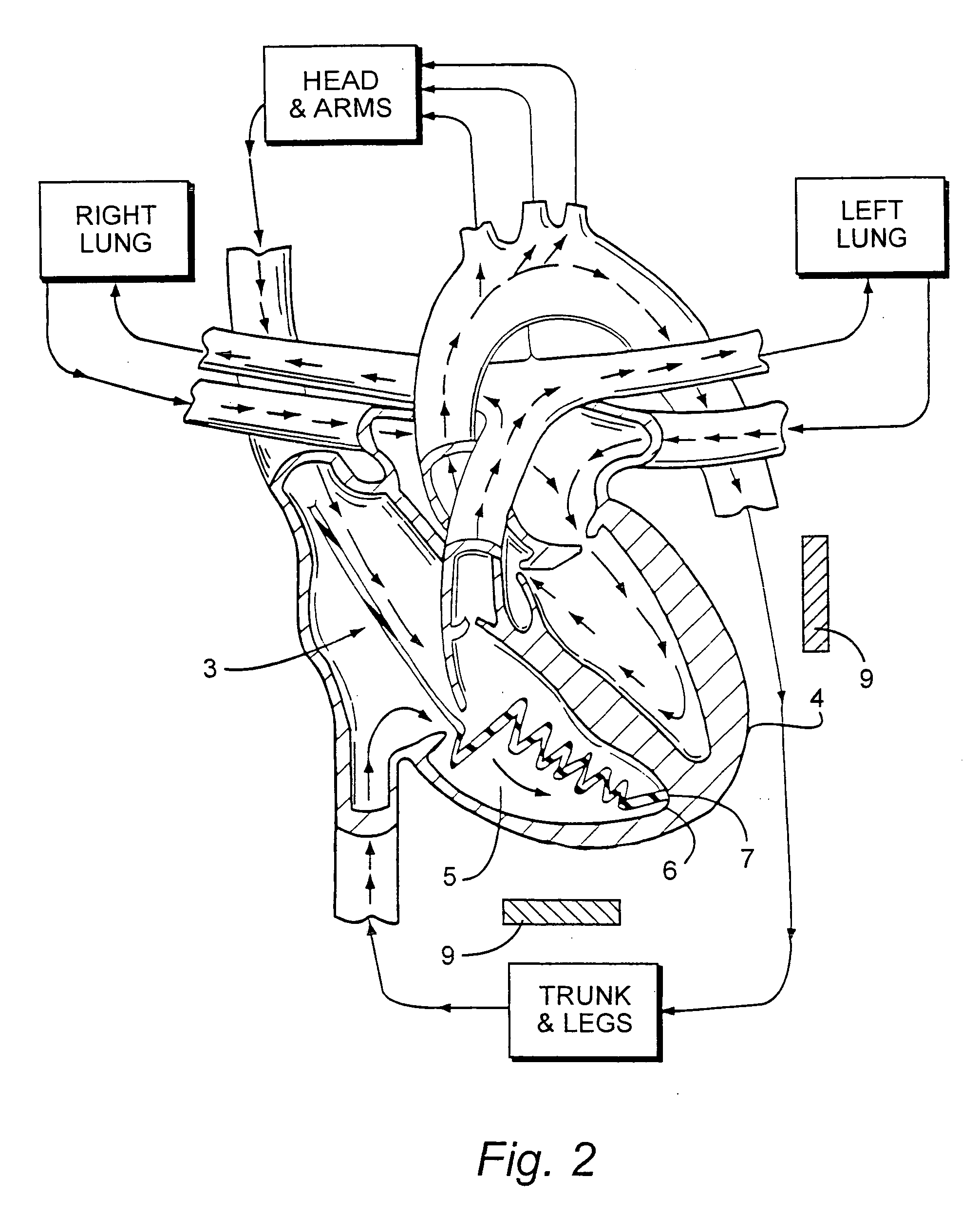 System and/or method for refibrillation of the heart for treatment of post-countershock pulseless electrical activity and/or asystole