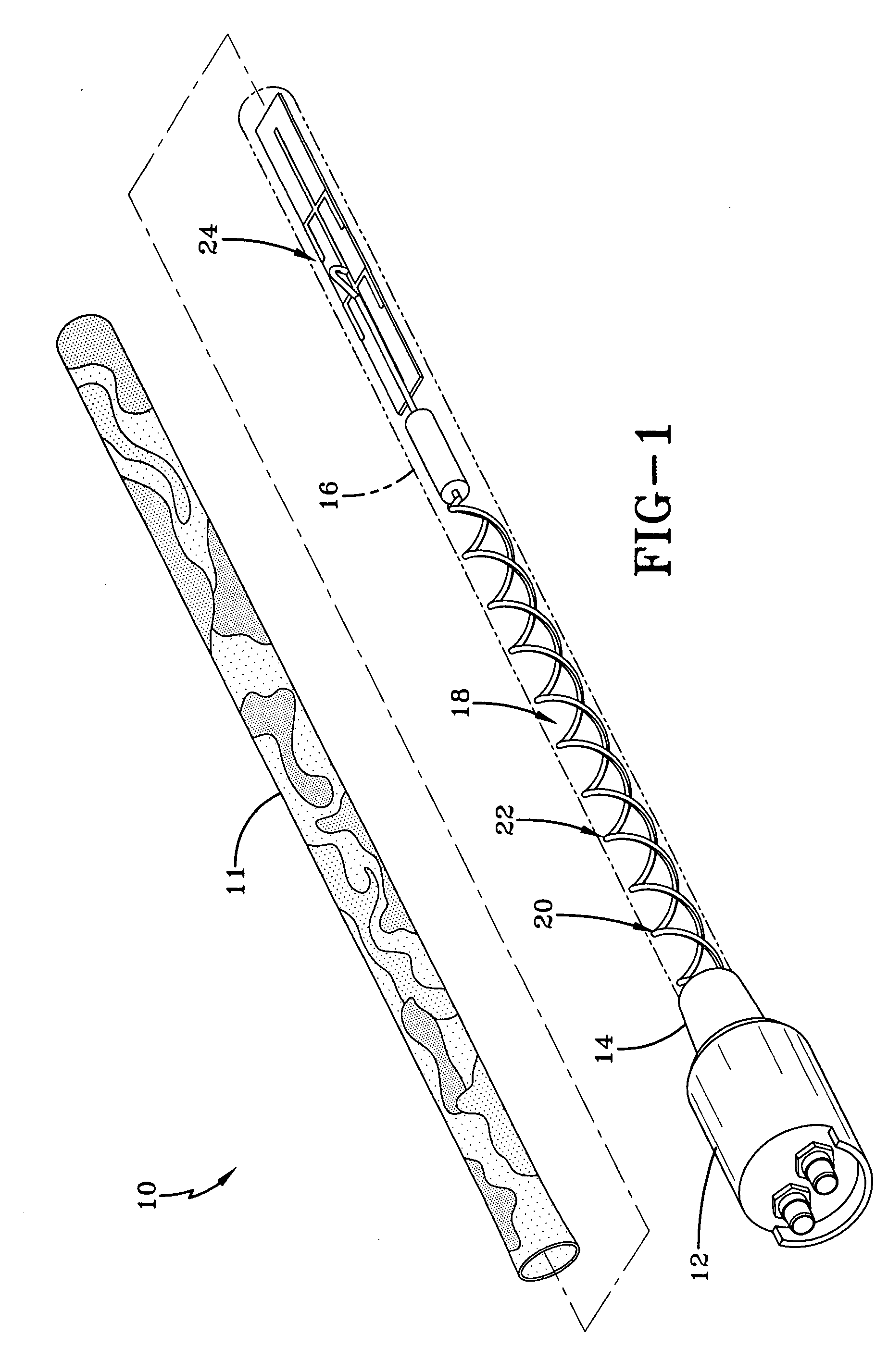 Small, narrow profile multiband antenna