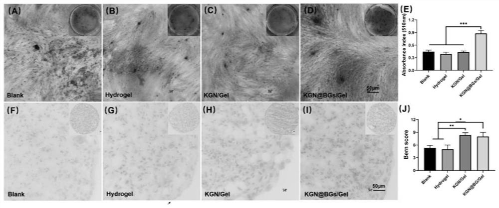 Composite hydrogel for promoting tendon-bone healing as well as preparation method and application thereof