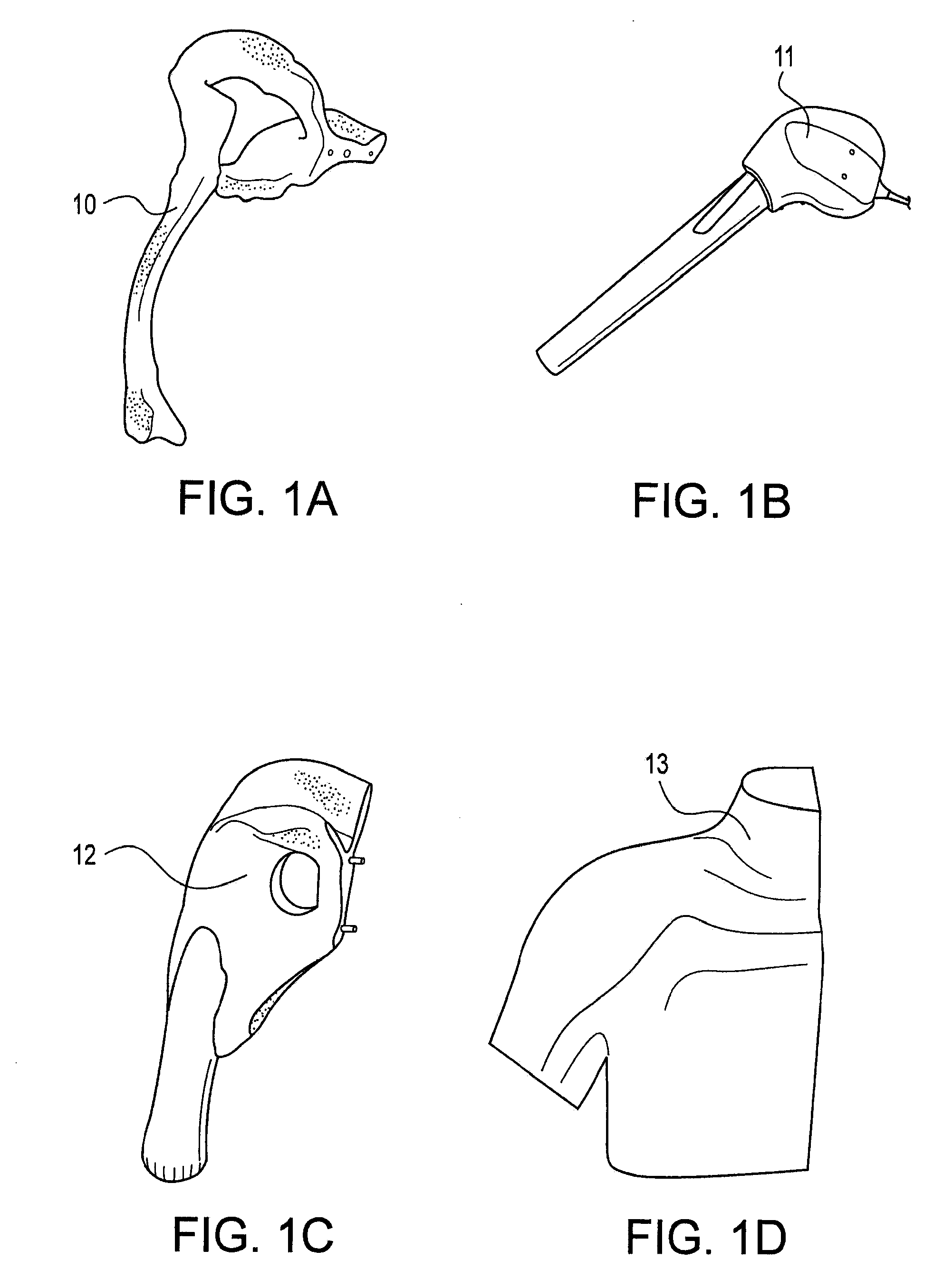 Shoulder model for shoulder arthroscopy