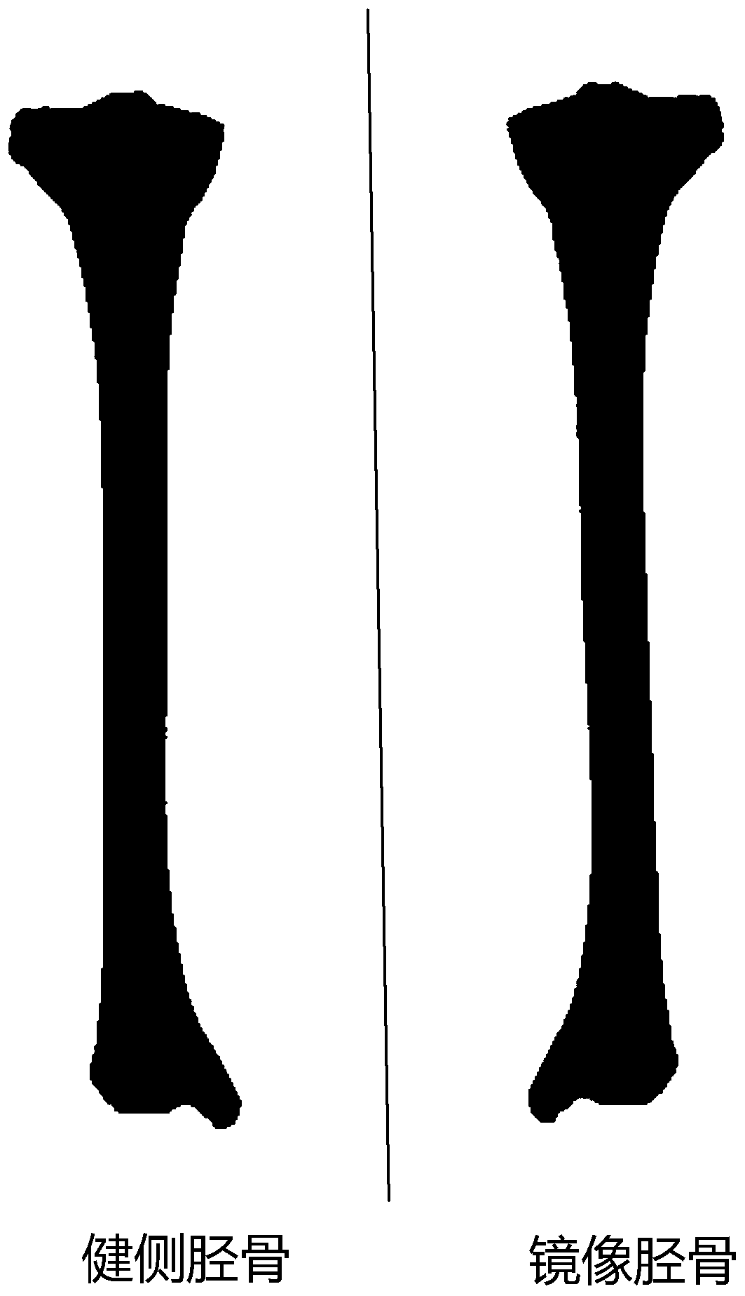 3D printing distal tibial plate and preparation method therefor