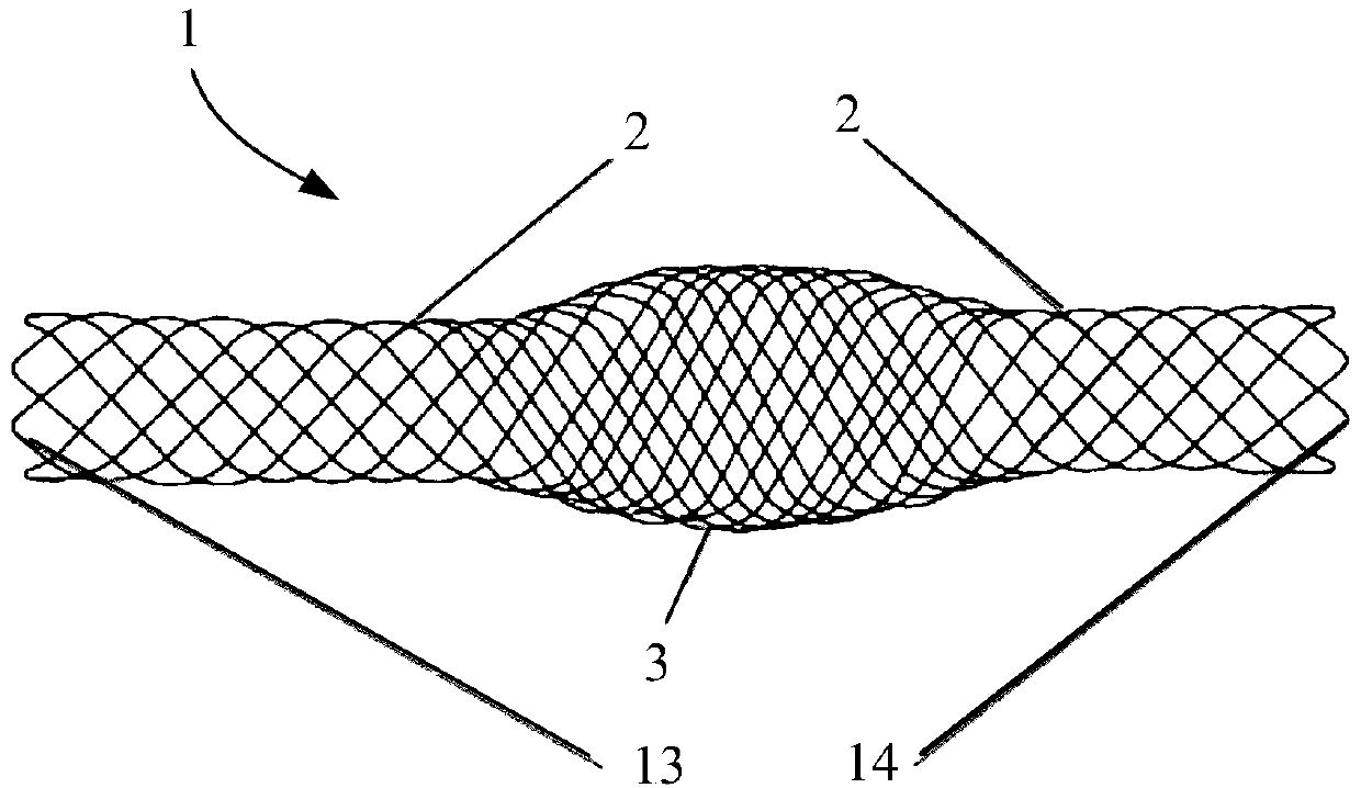 Stent, interventional medical device and interventional medical system