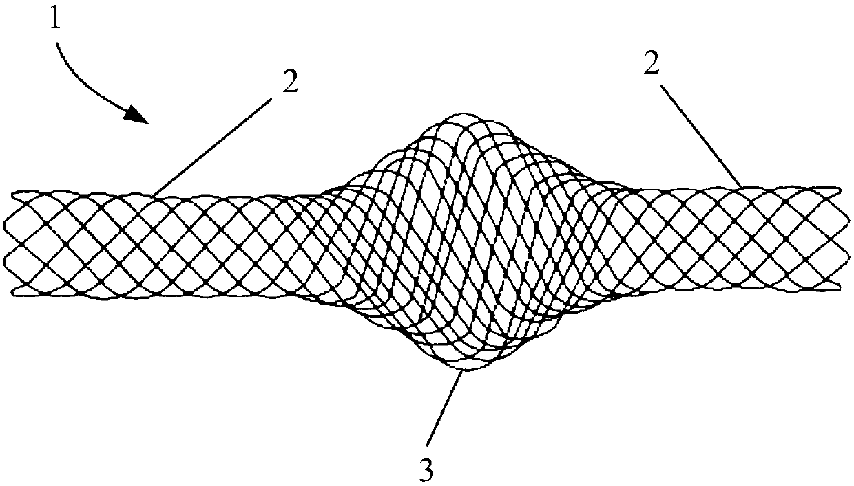 Stent, interventional medical device and interventional medical system