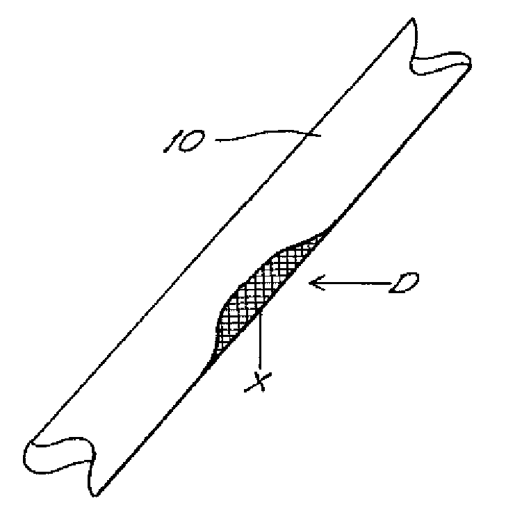 Bone Xenograft