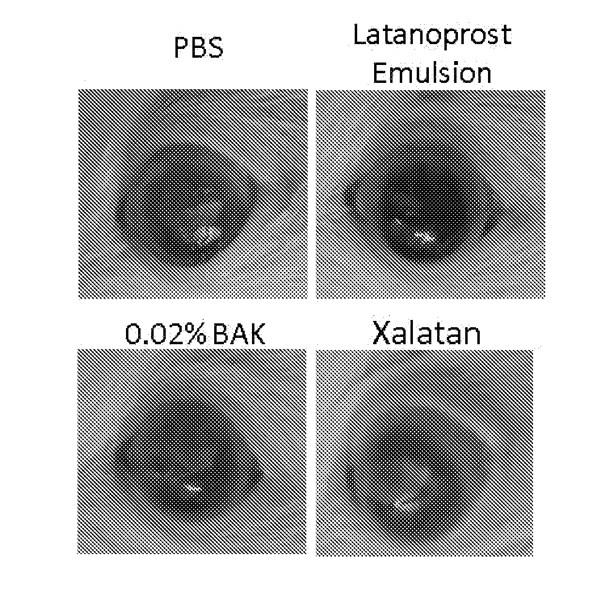 Use of Prostaglandins F2Alpha and Analogues for the Healing of Corneal and Conjunctival Lesions