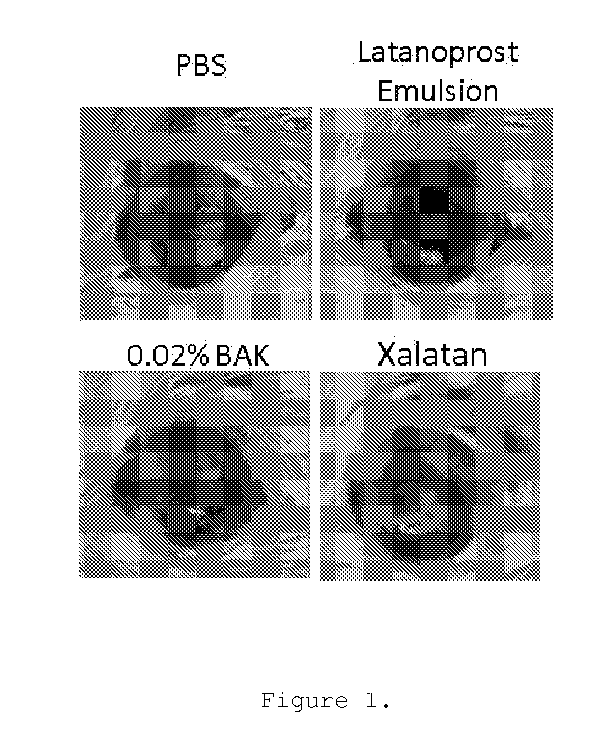 Use of Prostaglandins F2Alpha and Analogues for the Healing of Corneal and Conjunctival Lesions