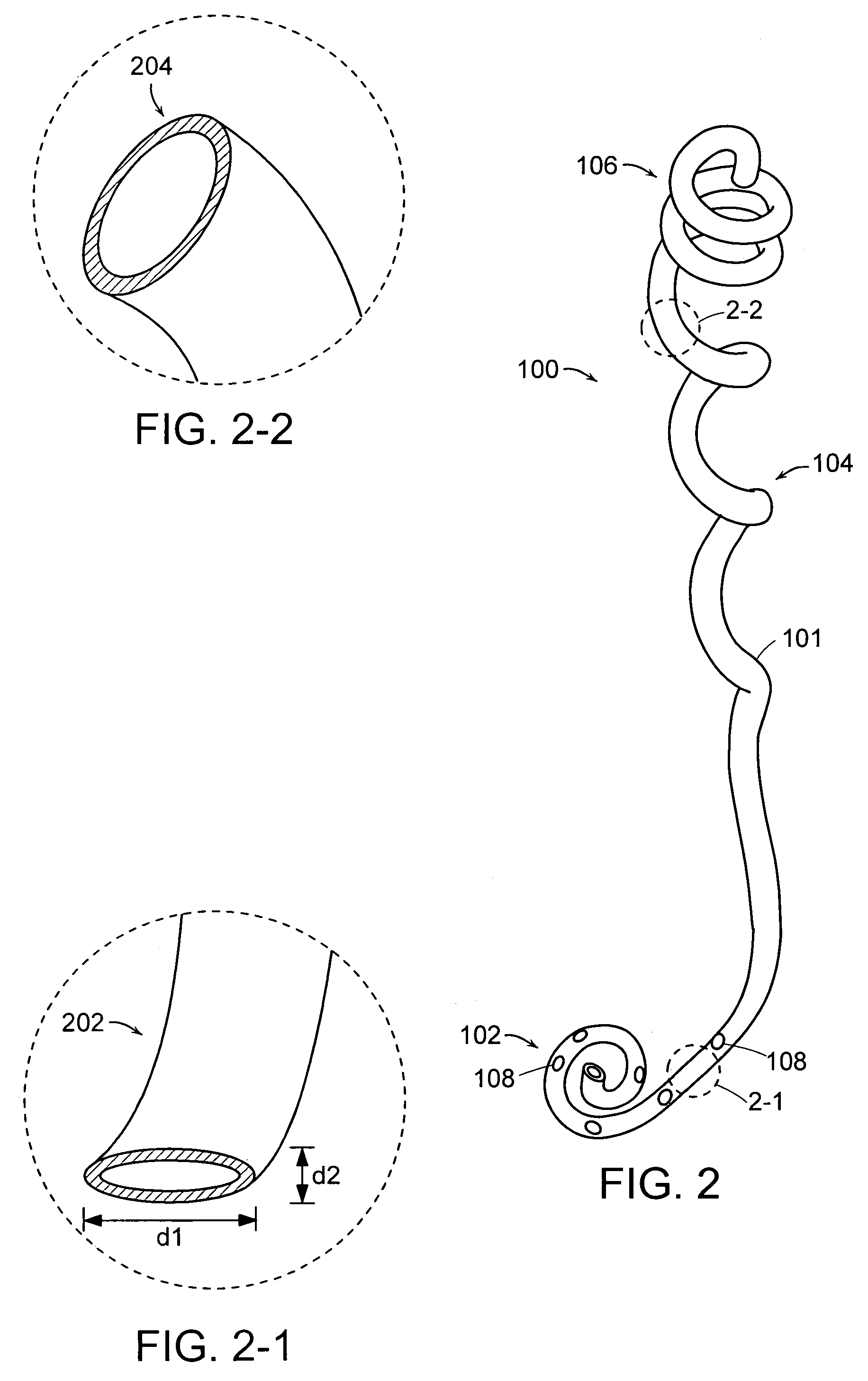 Ureteral stent configured for improved patient comfort and aftercare