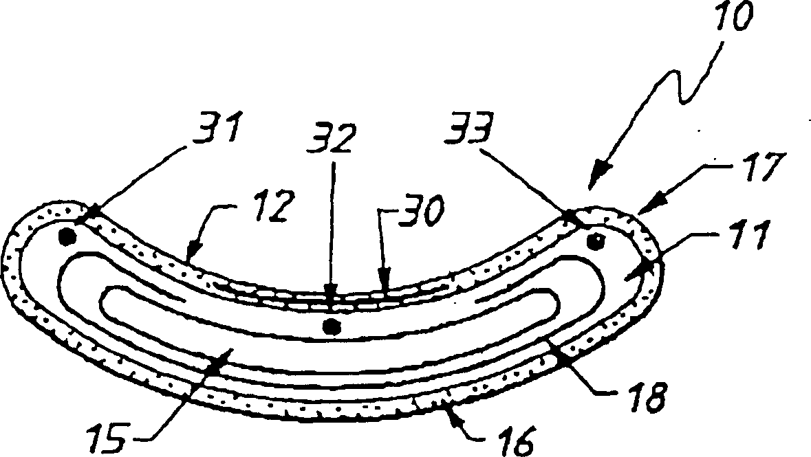 Assist device for failing heart