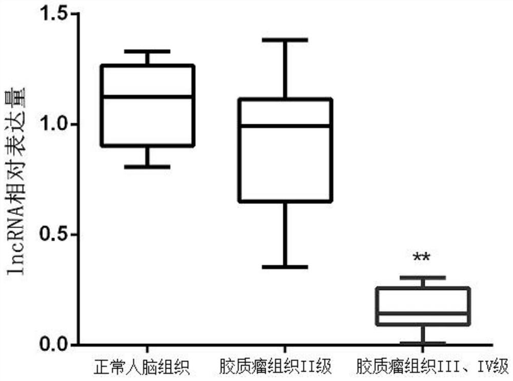 A glioma prognostic marker and its application