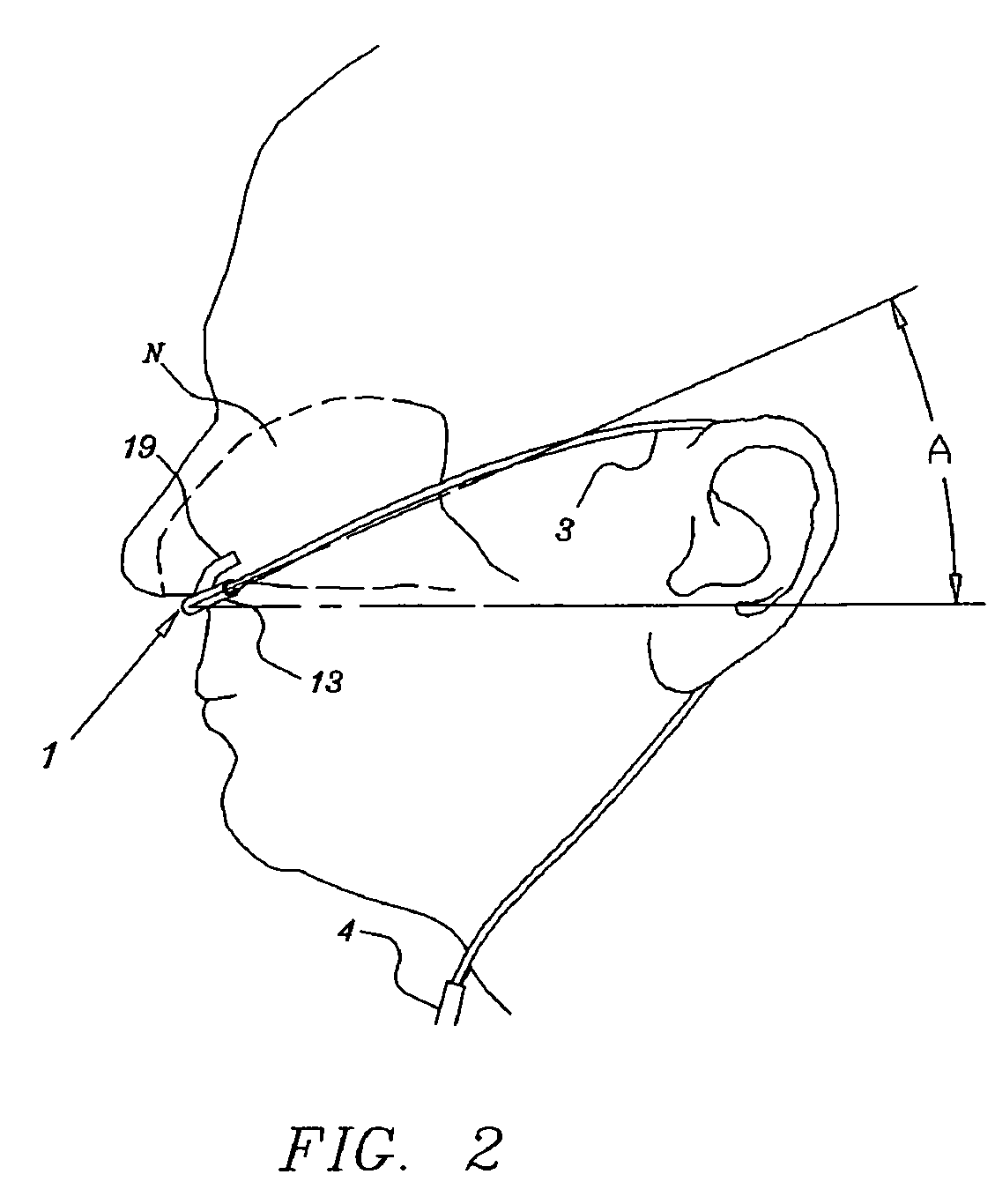 Nasal cannula assembly