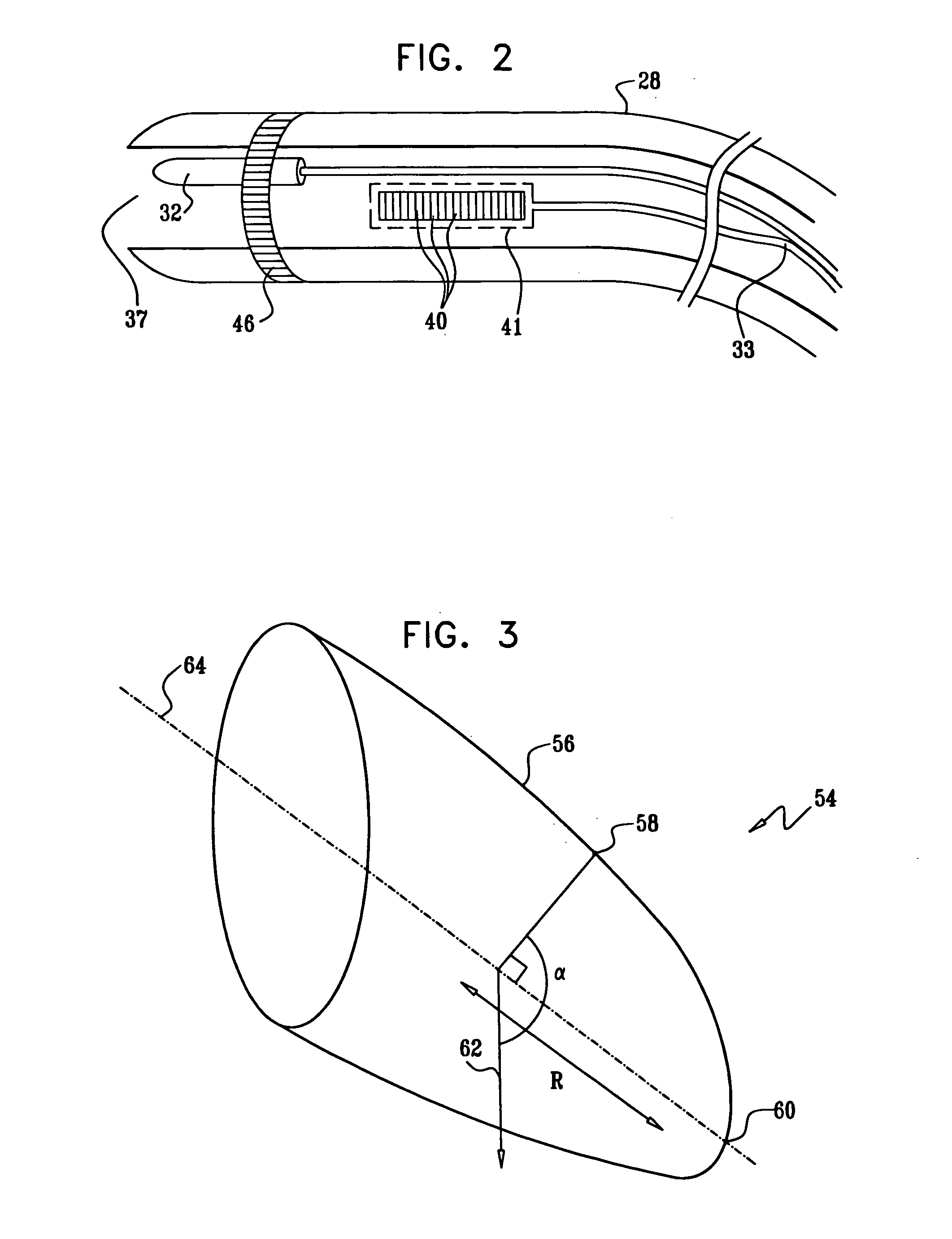 Monitoring of percutaneous mitral valvuloplasty