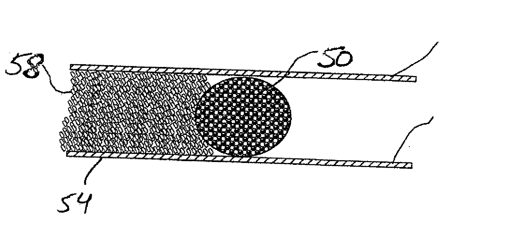 Compressible intravascular embolization particles and related methods and delivery systems