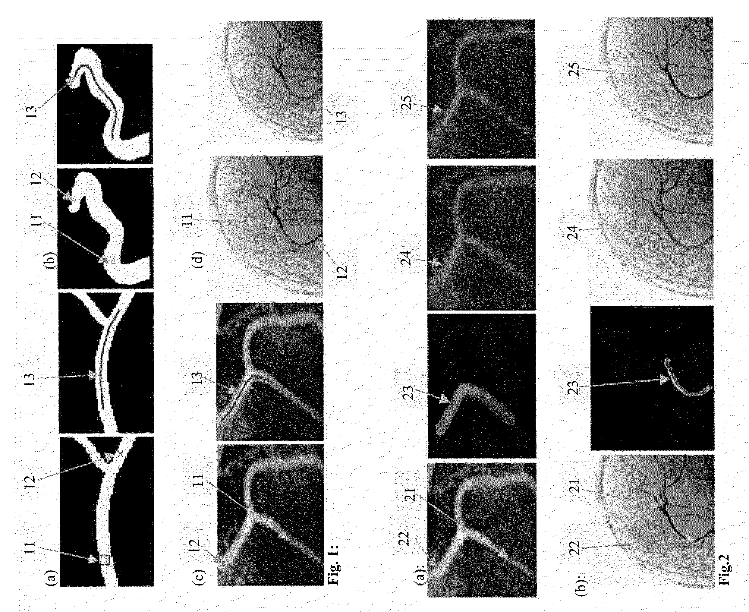 System and method for robust segmentation of tubular structures in 2D and 3D images