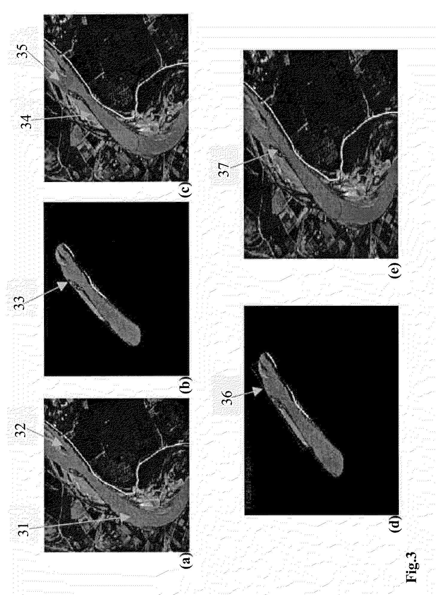 System and method for robust segmentation of tubular structures in 2D and 3D images