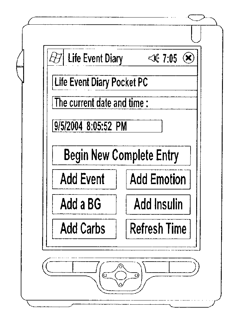 Computer-Implemented Method and Apparatus for Diabetes Management