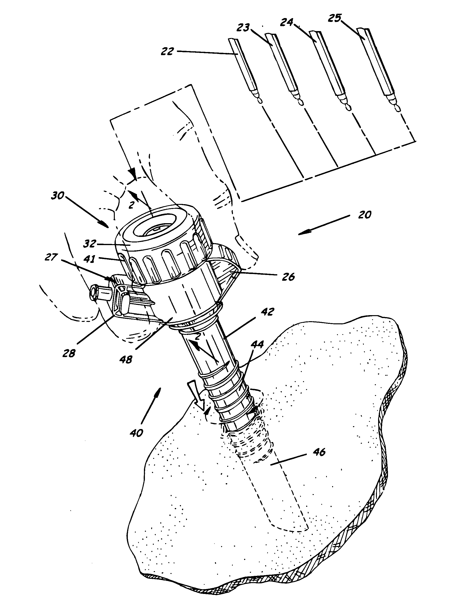 Trocar and cannula assembly having conical valve and related methods